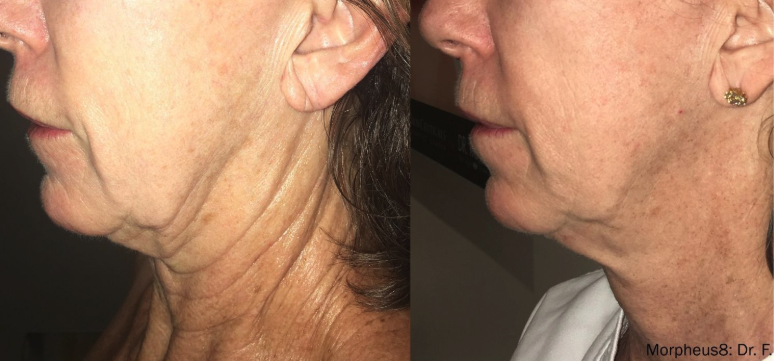 Screenshot 2025-04-30 at 5.00.52 PM